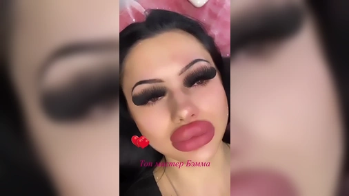 Allison 1