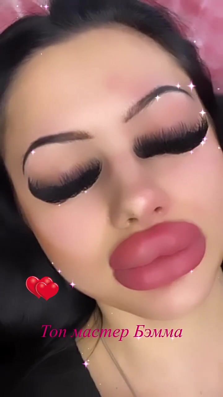 Allison 1